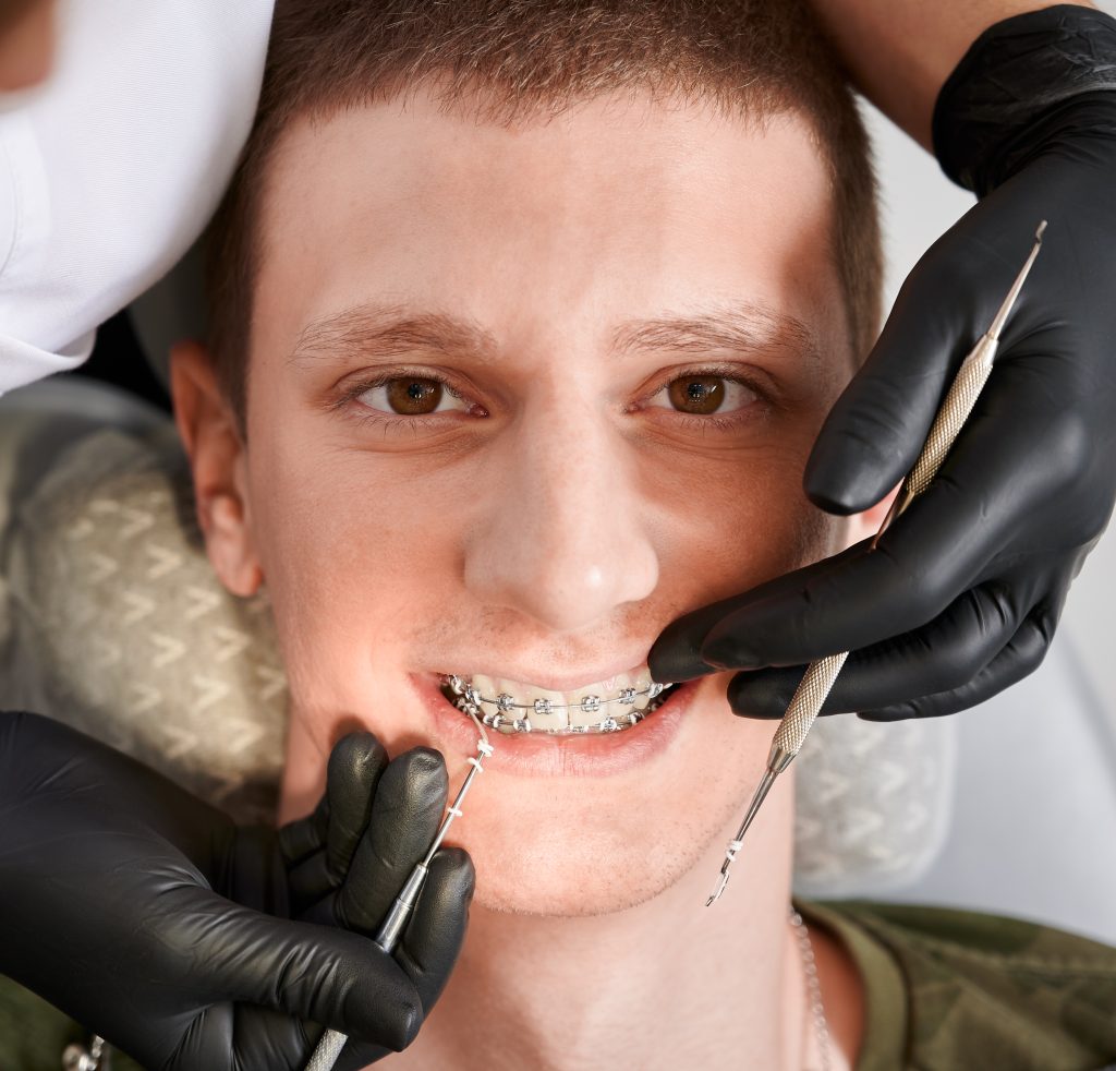 orthodontic specialist Milton