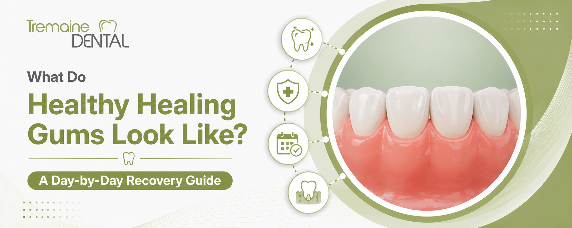 healthy gums